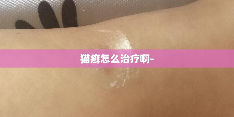 猫癣怎么治疗啊-