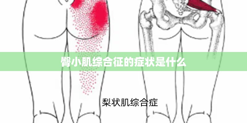 臀小肌综合征的症状是什么