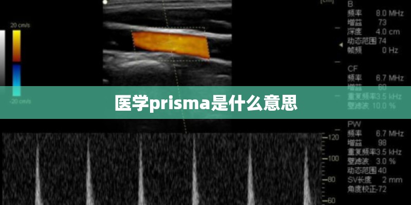 医学prisma是什么意思