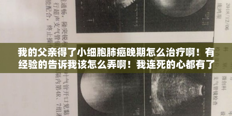 我的父亲得了小细胞肺癌晚期怎么治疗啊！有经验的告诉我该怎么弄啊！我连死的心都有了