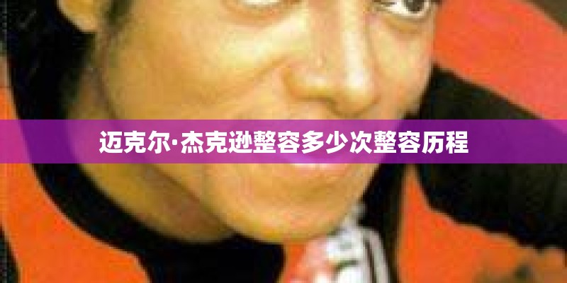 迈克尔·杰克逊整容多少次整容历程